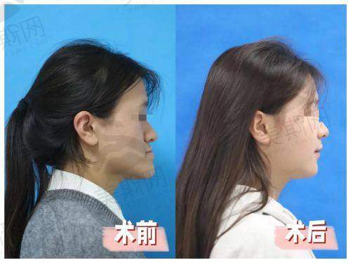 新疆乌鲁木齐优佳贝口腔医院预约挂号