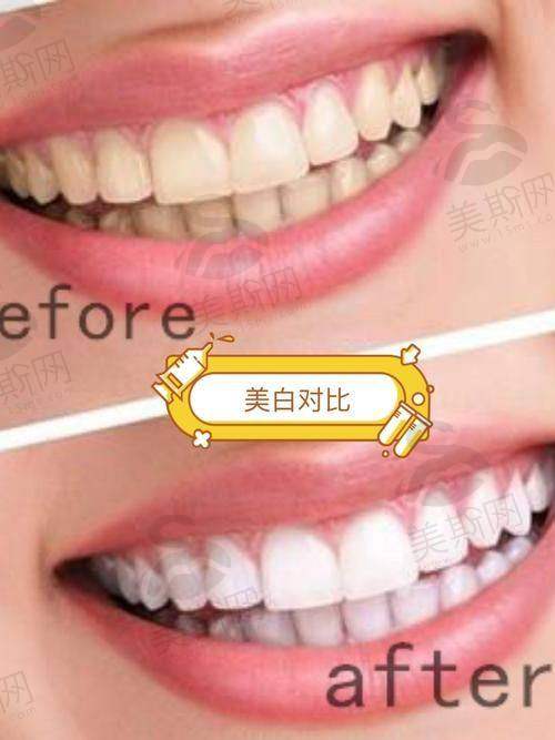 江西赣州唯乐口腔医院口碑如何