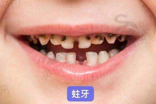 精细诊断:如同“超级飞侠”的导航系统,锁定病因本质