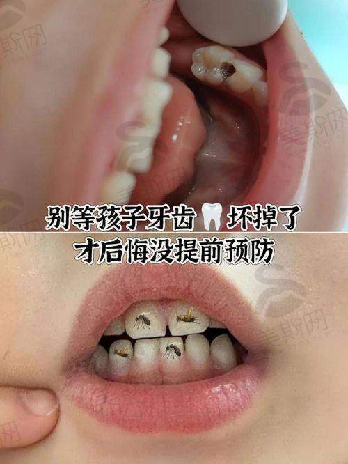乐迪医生2025年价格表
