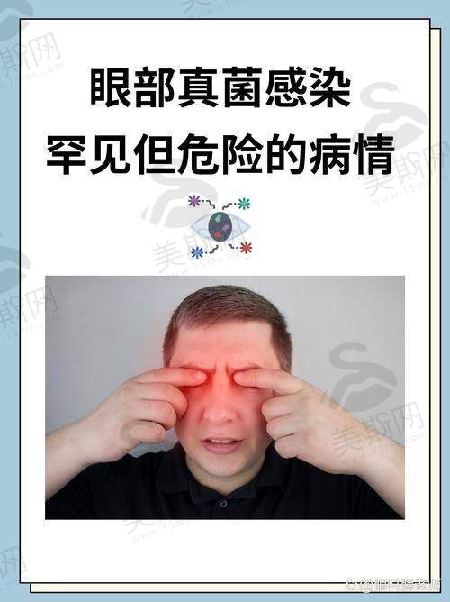 黄斑病变药物治疗常见误区及骨干医生建议