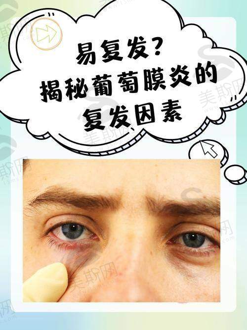 黄斑病变治疗更有效的药物分类及作用机制解析