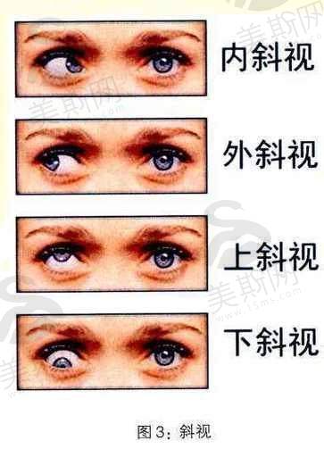 新民市人民医院眼科口碑如何