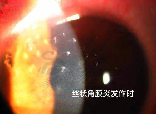 广西医科大学第一附属医院眼科诊疗项目