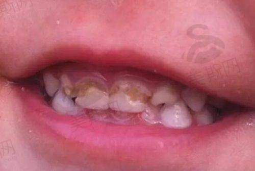 重庆观音桥牙科诊所推荐