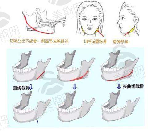 邯郸整形医院排名前十补充