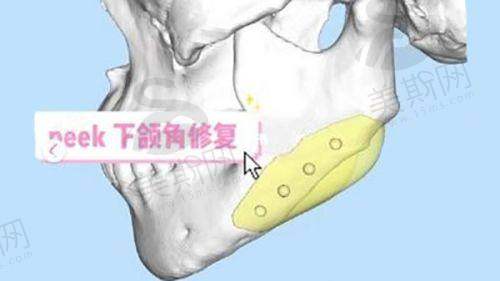 总结