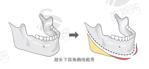 微整与皮肤光电多面手——周泉医生