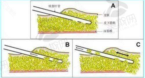 总结