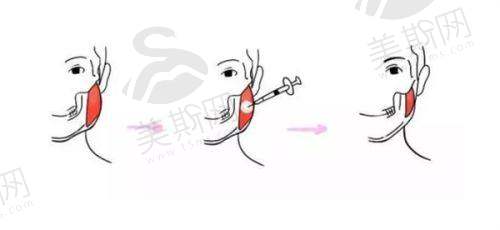 西安妇科整形比较好的医院