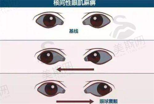 河南省人民医院眼科收费标准揭秘!挂号费、手术费用等各项收费到底多少?