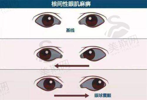 临汾洛基眼科医院是国有吗