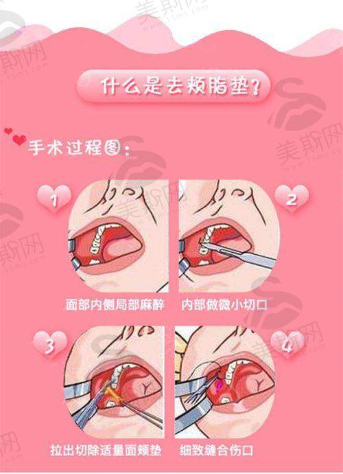 面部轮廓塑造领域可靠医生——张庆国医生