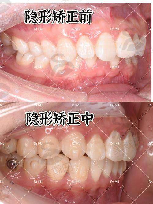 山东泰安和睦口腔医院正规吗?