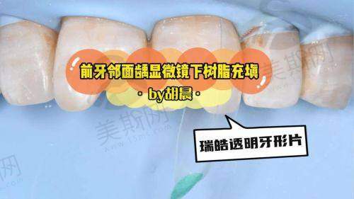 中日友好医院口腔科怎么样？