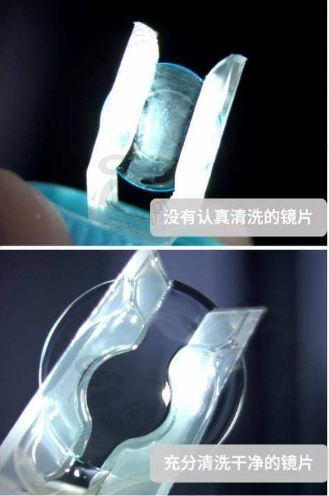 褚仁远医生技术水平高