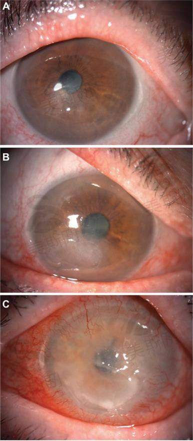 徐建江医生坐诊医院:复旦大学附属眼耳鼻喉科医院