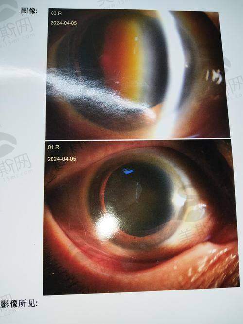 徐格致医生擅长项目