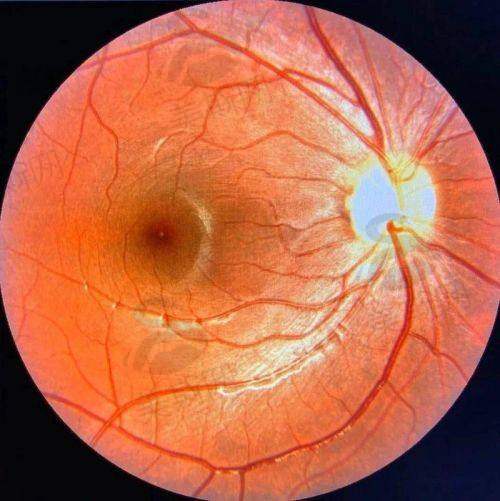 三、个体化治疗方案制定