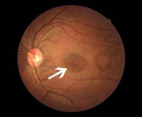江睿医生技术水平高