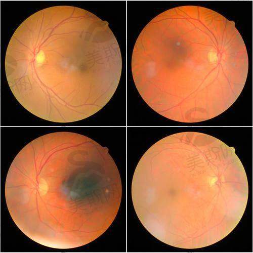 方式二：电话预约