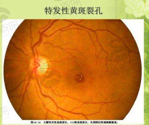 江睿医生擅长项目