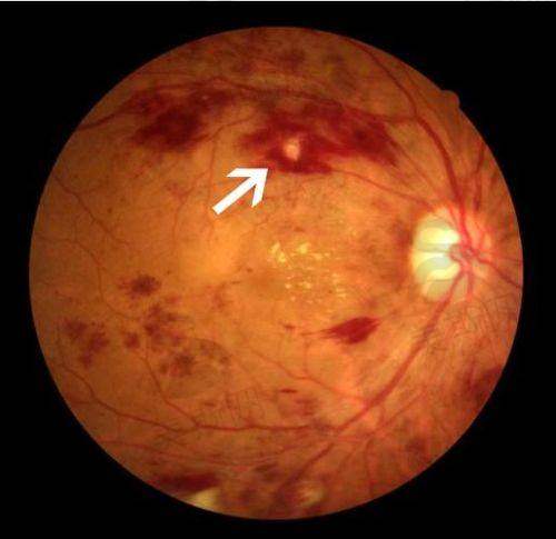 陈玲医生预约挂号
