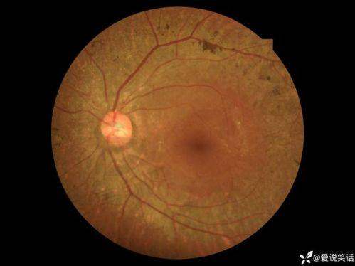 方式三：现场预约