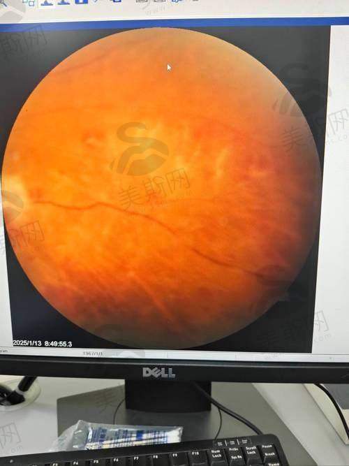 四、并发症防控体系完善