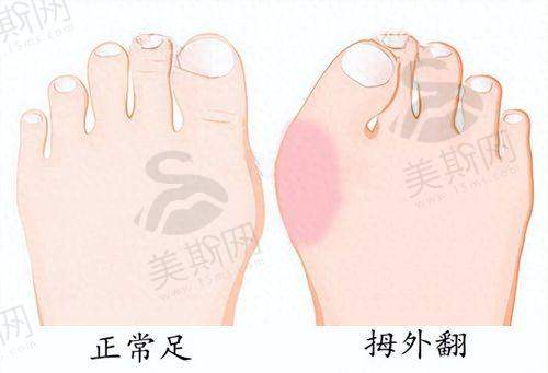 总结