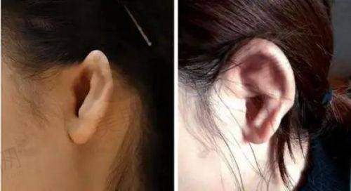 总结