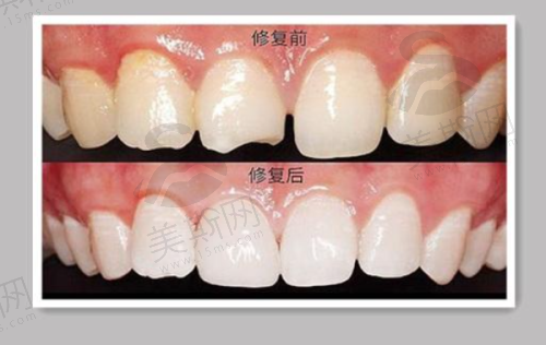 贵阳林陈郎朗口腔医院情况