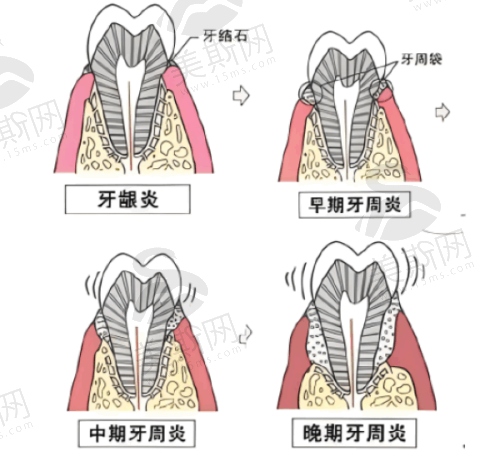 选择牙齿矫正机构的建议