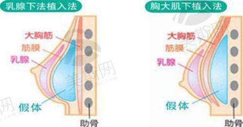 广州广大正颌手术成效如何