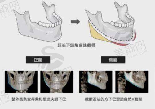 深圳阳光医院是三等甲医院吗