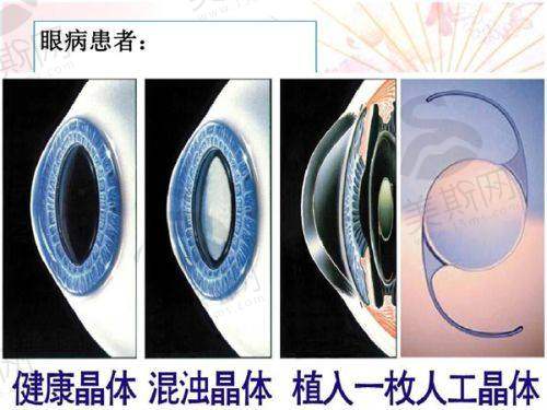 总结