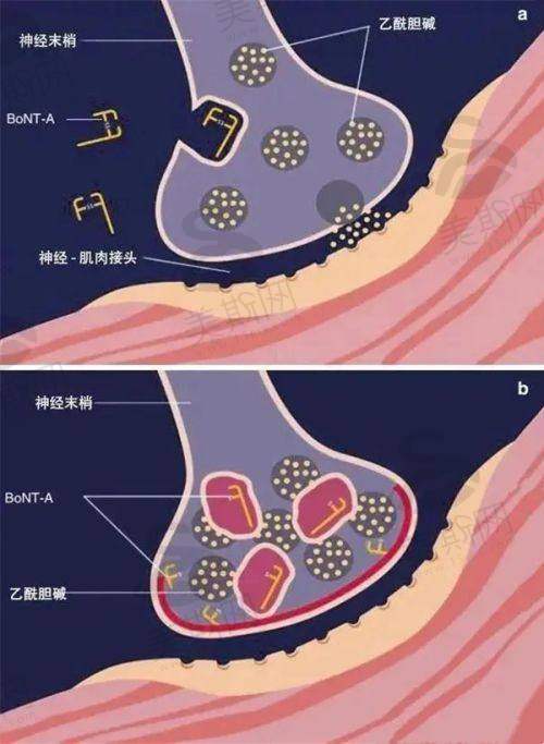 余文林医生唇裂修复价格费用