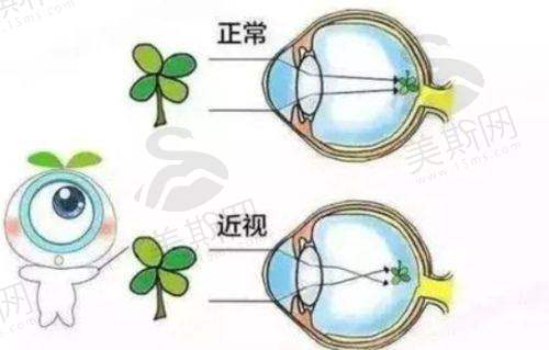 合肥普瑞眼科医院具体信息