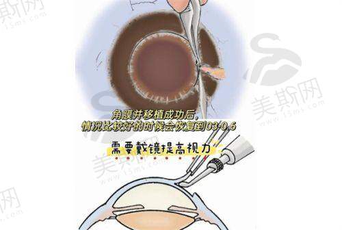 合肥排名前五的眼科医院详细介绍