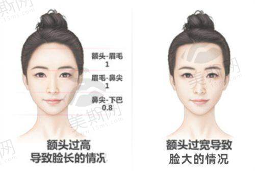 余文林医生唇裂修复手术次数