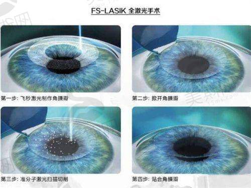 合肥普瑞眼科医院挂号预约流程大揭秘，网上挂号、现场预约全攻略看这里