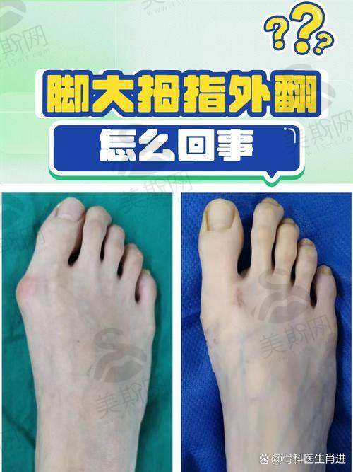 3、成都大脚骨微创手术费用排名第三：成都铜雀台整形医院