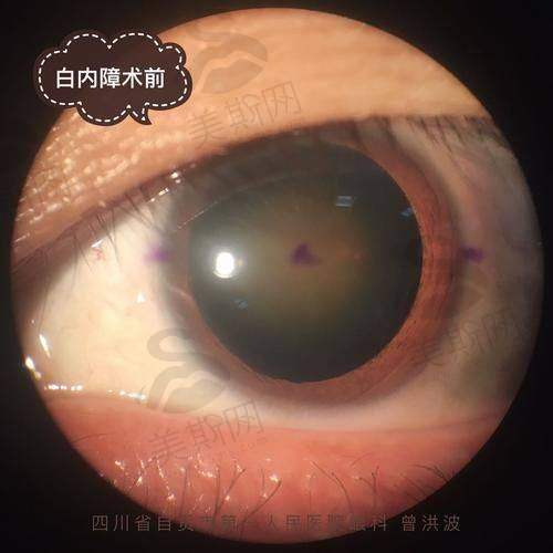 复旦大学附属眼耳鼻喉科医院眼科地址电话