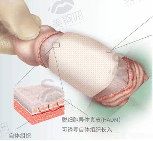 手术过程及修复情况