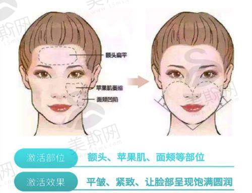 东莞壹加壹整形医院收费标准查询，涵盖各项目收费、手术及美容收费明细全揭秘！