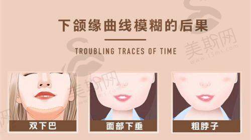 郑小红双眼皮修复13000元起真不贵，看郑小红医生案例，探究上海郑小红双眼皮及修复价格合理性