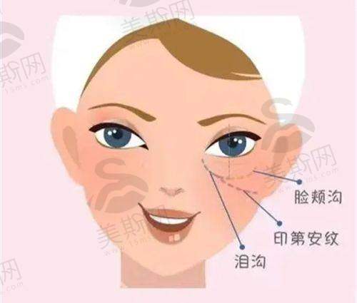 术后护理要点