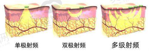 总结