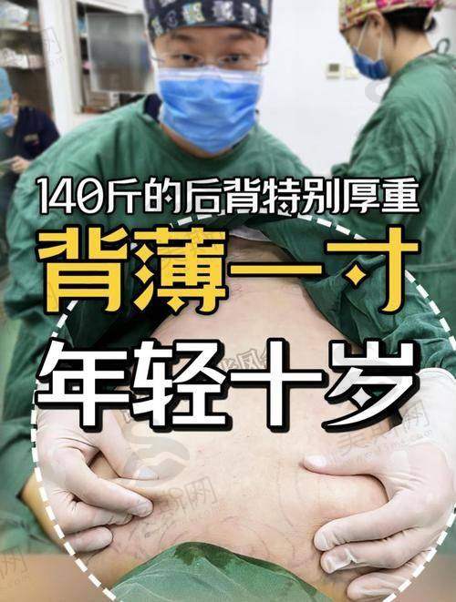 三、兰斯背部吸脂怎么选？价格、医院、医生避坑指南