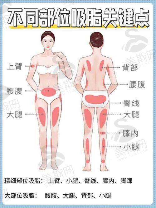 二、从圆肩厚背到蝴蝶骨：韩国365mc医院3个真实实例拆解
